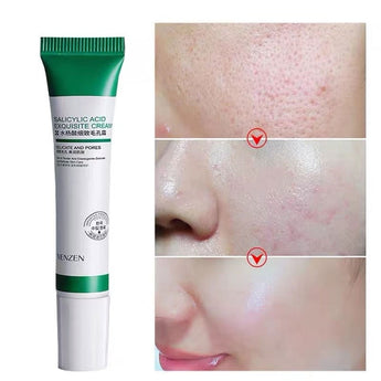 20g Salicylic Acid Pore Refining Cream Gel Moisturizing Oil Control Pore Refining Repairing Refreshing Mild Skin Care TSLM1